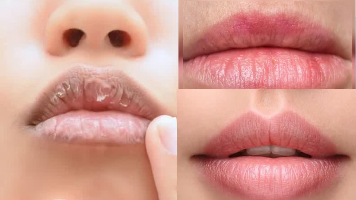 LIPS 