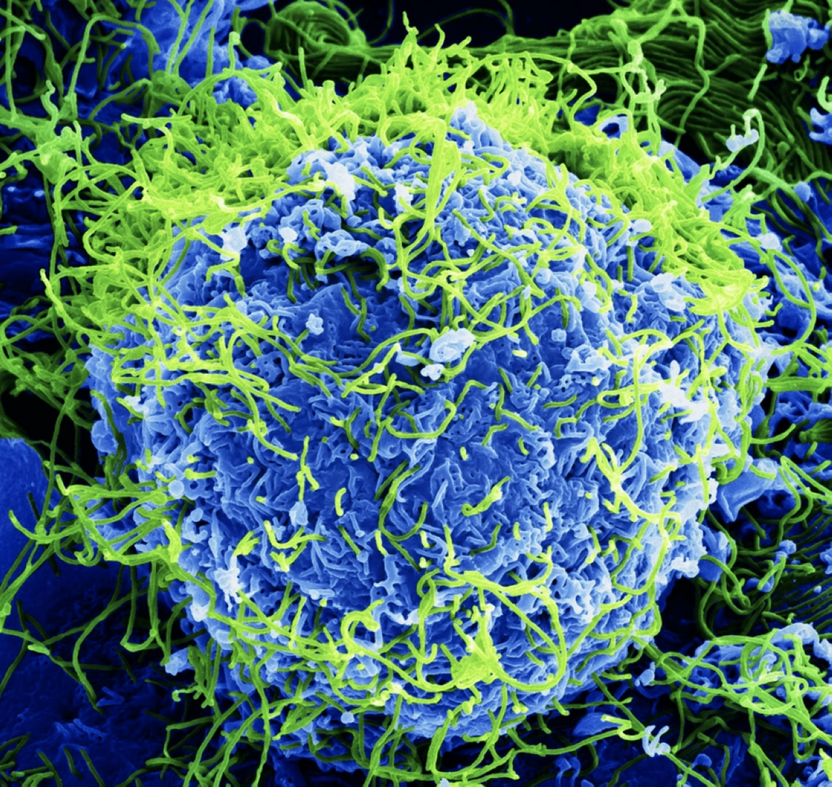Saudi Arabia Ebola virus 